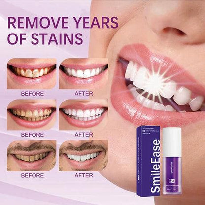 V34 Purple Teeth Whitening Toothpaste – Remove Yellow Stains & Brighten Smile Instantly